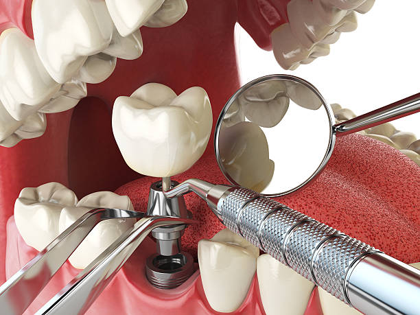 Best Weekend Emergency Dentist in Huntingdon, TN
