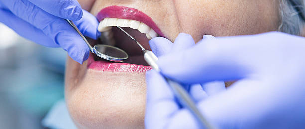Best Broken or Cracked Tooth Emergency Dentist in Huntingdon, TN